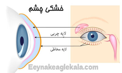 بررسی خشکی چشم عینک ایگل کالا